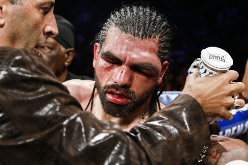 Angulo's Eye
